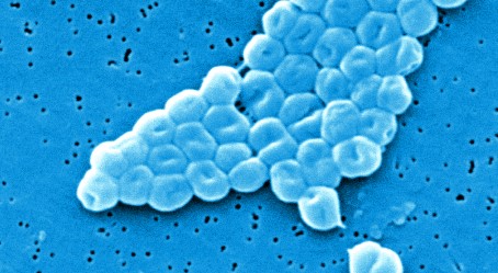 Multiresistentes Bakterium: Infektion von zwölf Patienten mit MRGN-Keim am Campus Kiel