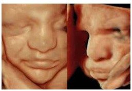 Fetus mit 31 Schwangerschaftswochen: Erst lächelt das Ungeborene etwas, wenige Minuten später zeigt es ein missmutiges Gesicht. (Quelle: Prof. E. Merz)
