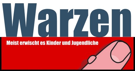 Warzen sind weit verbreitet und in der Regel harmlos